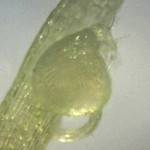 Utricularia bisquamata trap X200 magnification Utricularia bisquamata trap X200 magnification